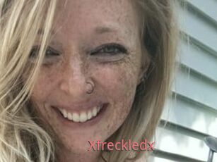 Xfreckledx